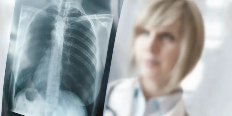 Fachärztliche Auswertung eines Lungenröntgenbilds – moderne Diagnostik bei Husten, Luftnot und chronischen Atemwegserkrankungen in Frankfurt